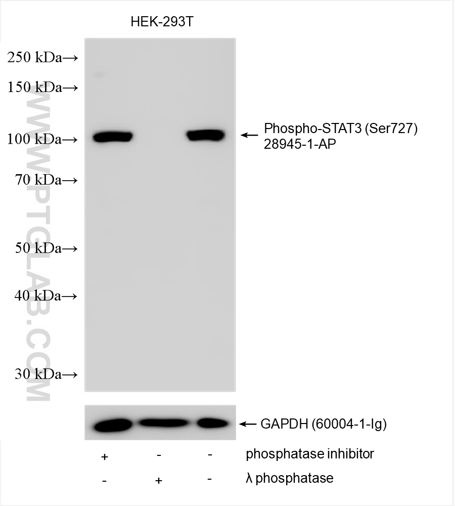 Phospho-STAT3 (Ser727)