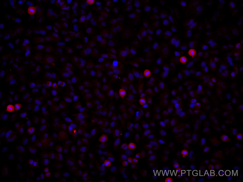 Phospho-STAT3 (Ser727)