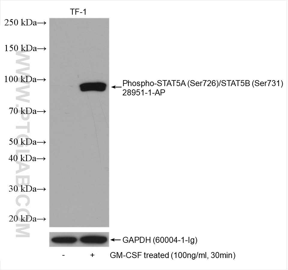 Phospho-STAT5A (Ser726)/STAT5B (Ser731)