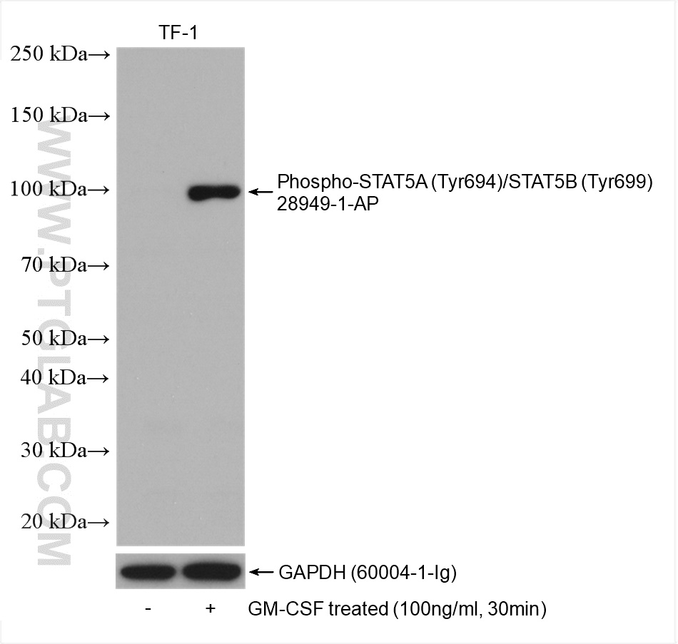 Phospho-STAT5A (Tyr694)