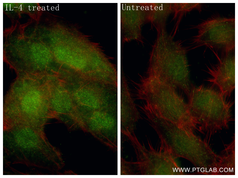 IF Staining of ACHN using 86641-1-RR