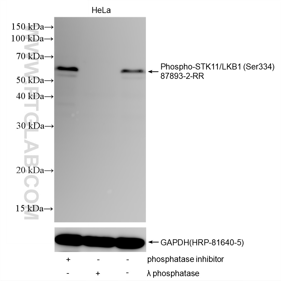 WB analysis using 87893-2-RR WB analysis using 87893-2-RR
