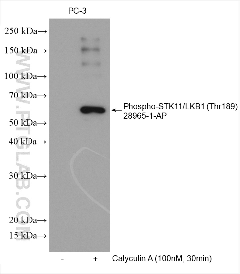 WB analysis using 28965-1-AP