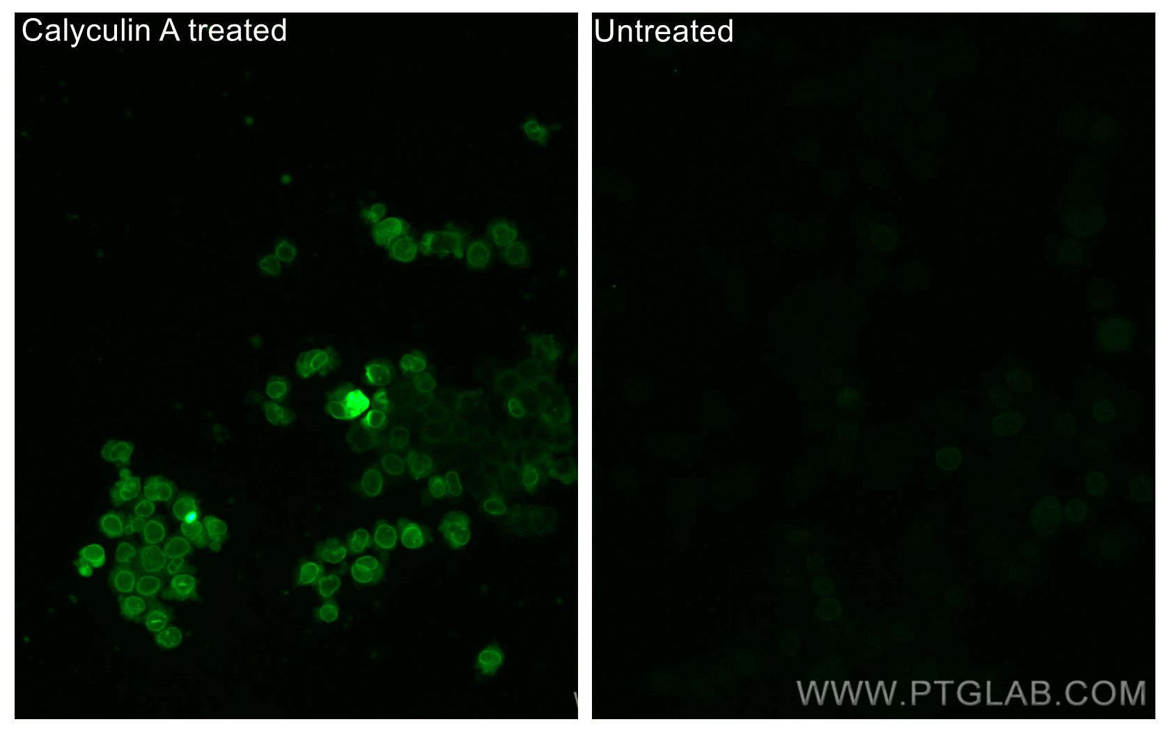 IF Staining of PC-3 using 80127-1-RR