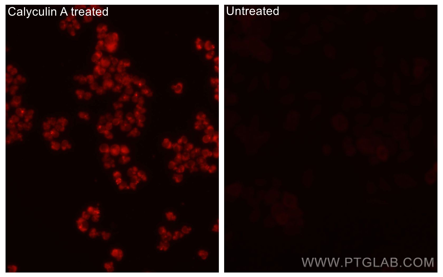 IF Staining of PC-3 using CL647-80127