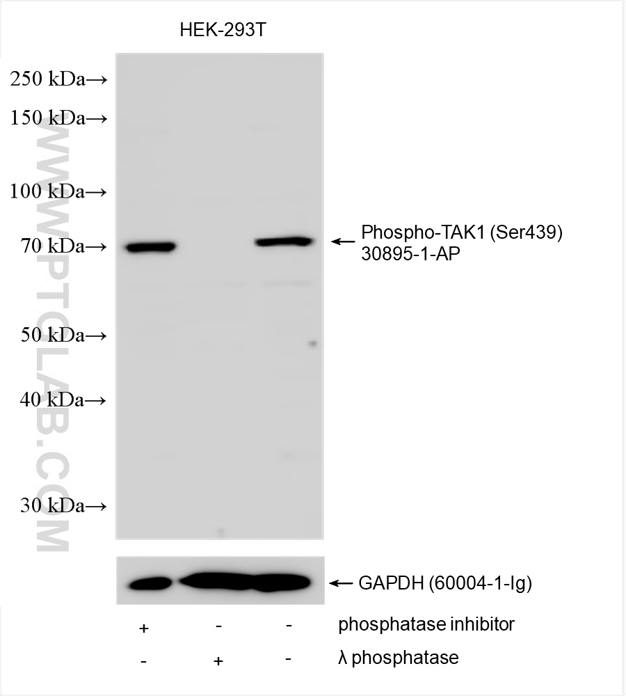 Phospho-TAK1 (Ser439)