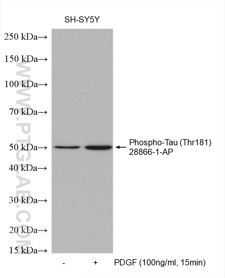 Phospho-TAU (Thr181)