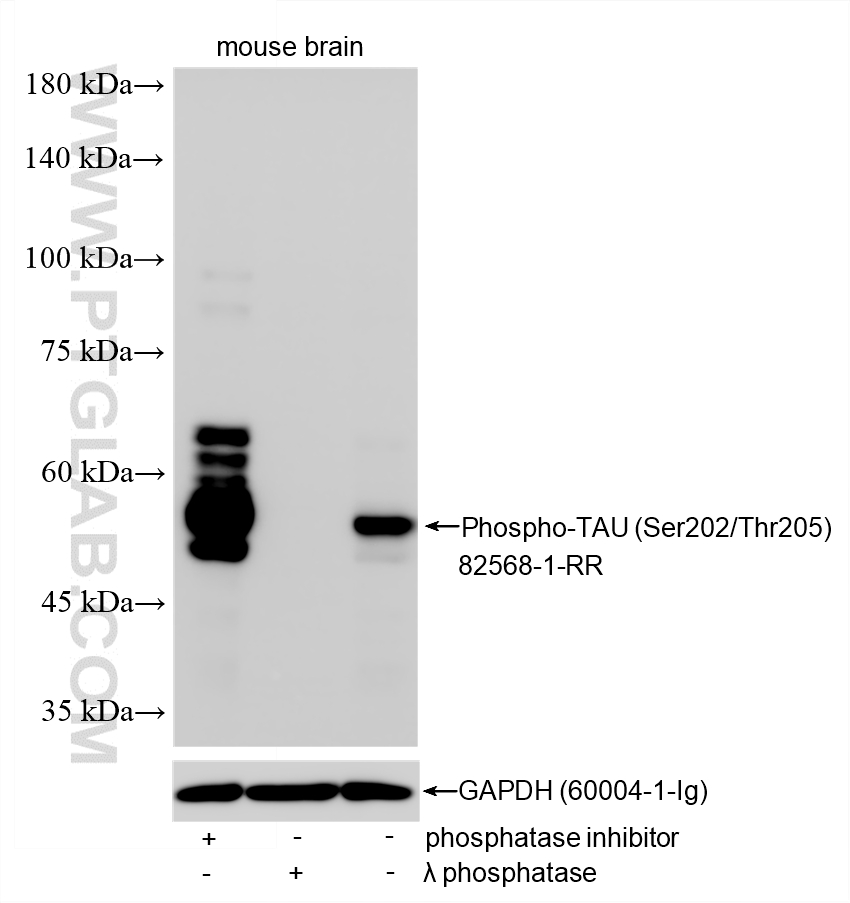 Various lysates were subjected to SDS PAGE followed by western blot with 82568-1-RR (Phospho-TAU (Ser202/Thr205) antibody) at dilution of 1:20000 incubated at room temperature for 1.5 hours. WB analysis using 82568-1-RR