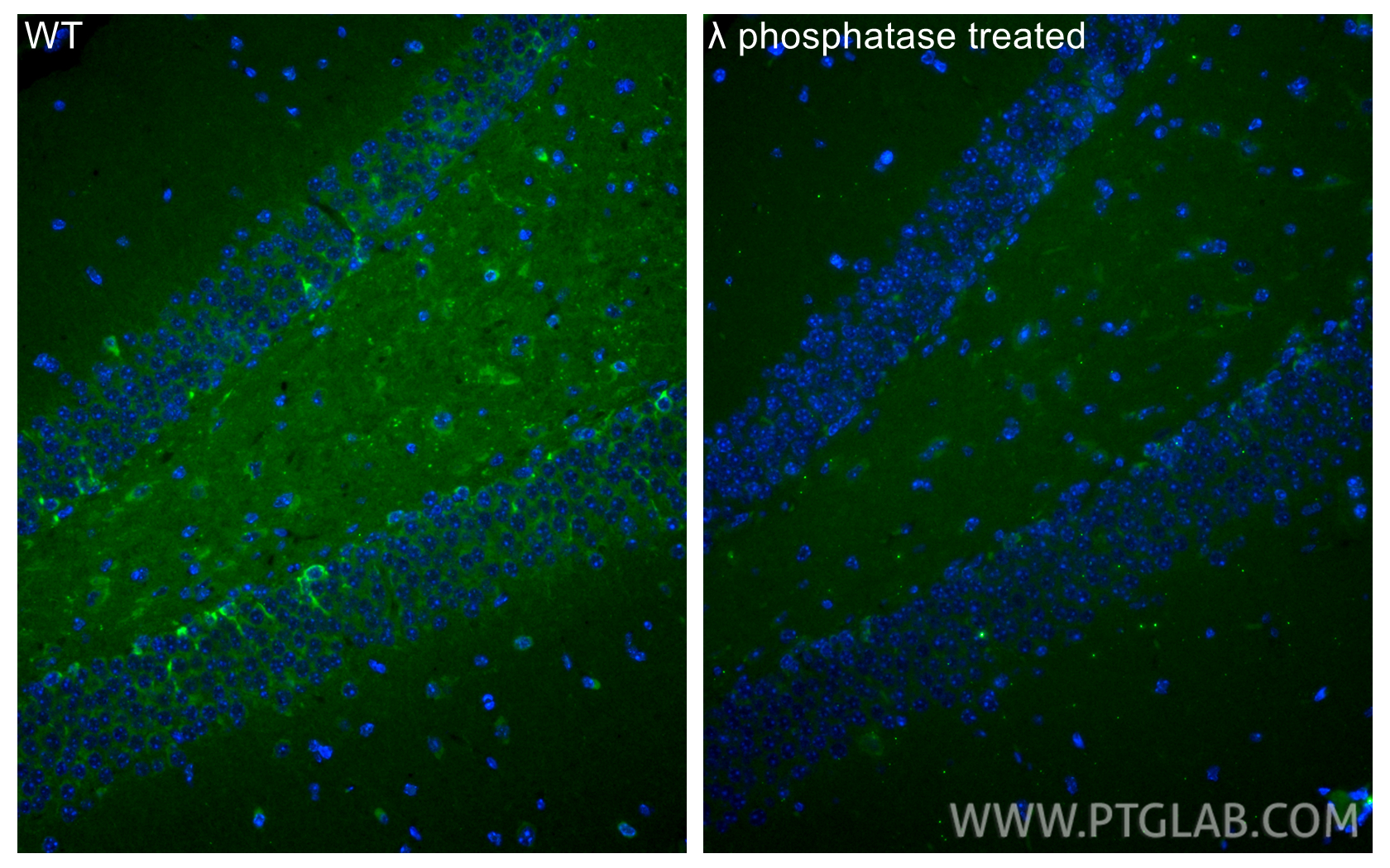 IF Staining of mouse brain using CL488-82568 IF Staining of mouse brain using CL488-82568