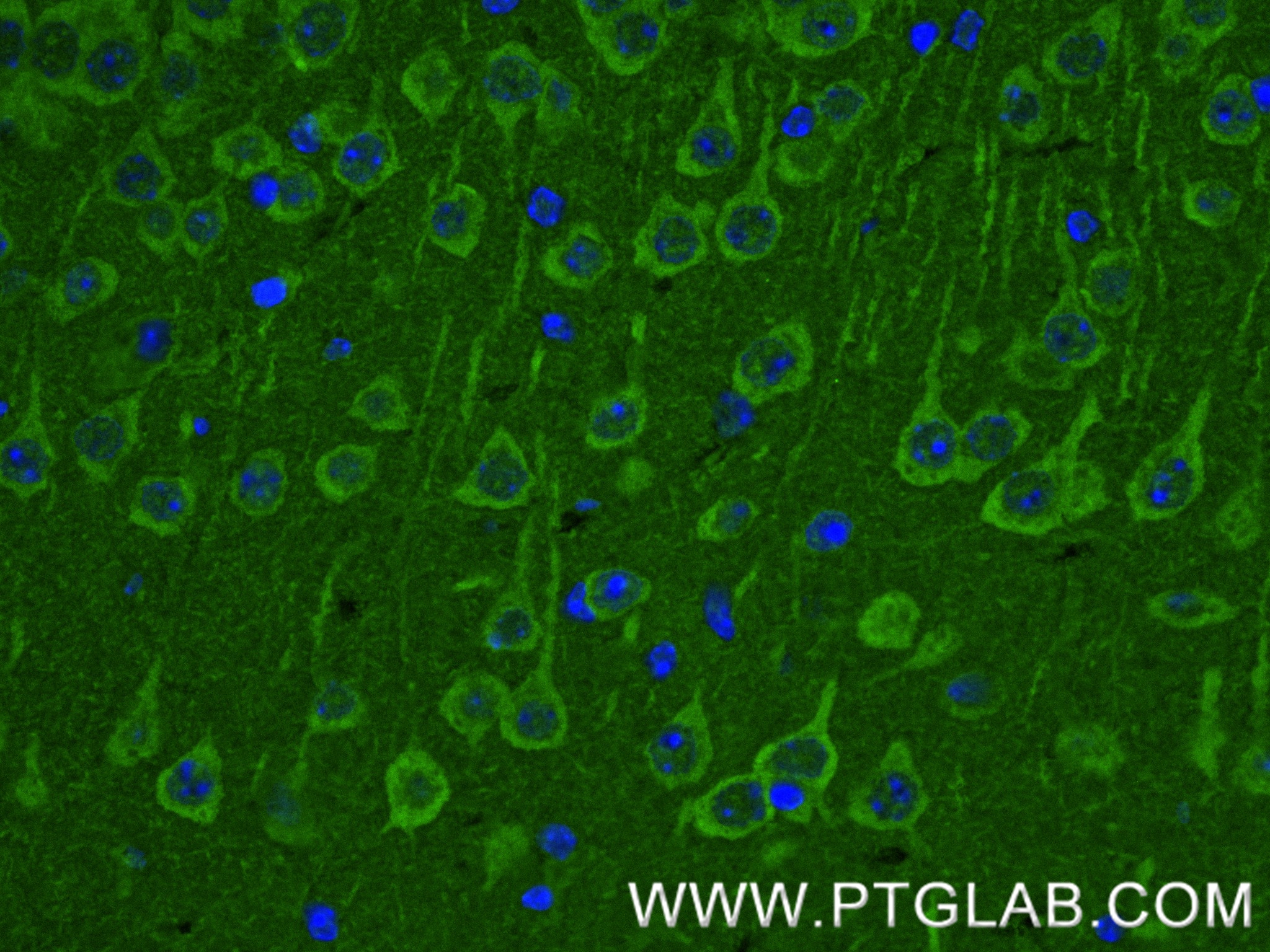 IF Staining of mouse brain using 87043-3-RR IF Staining of mouse brain using 87043-3-RR