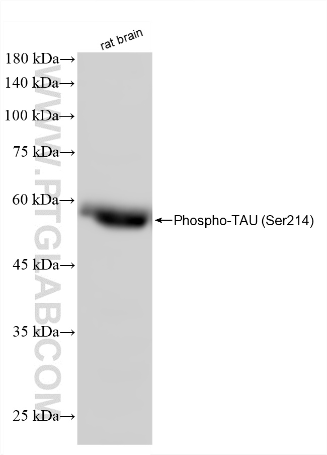 WB analysis of rat brain using 87043-3-RR (same clone as 87043-3-PBS) WB analysis of rat brain using 87043-3-RR (same clone as 87043-3-PBS)