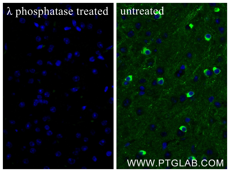 IF Staining of mouse brain using 87029-11-RR (same clone as 87029-11-PBS)