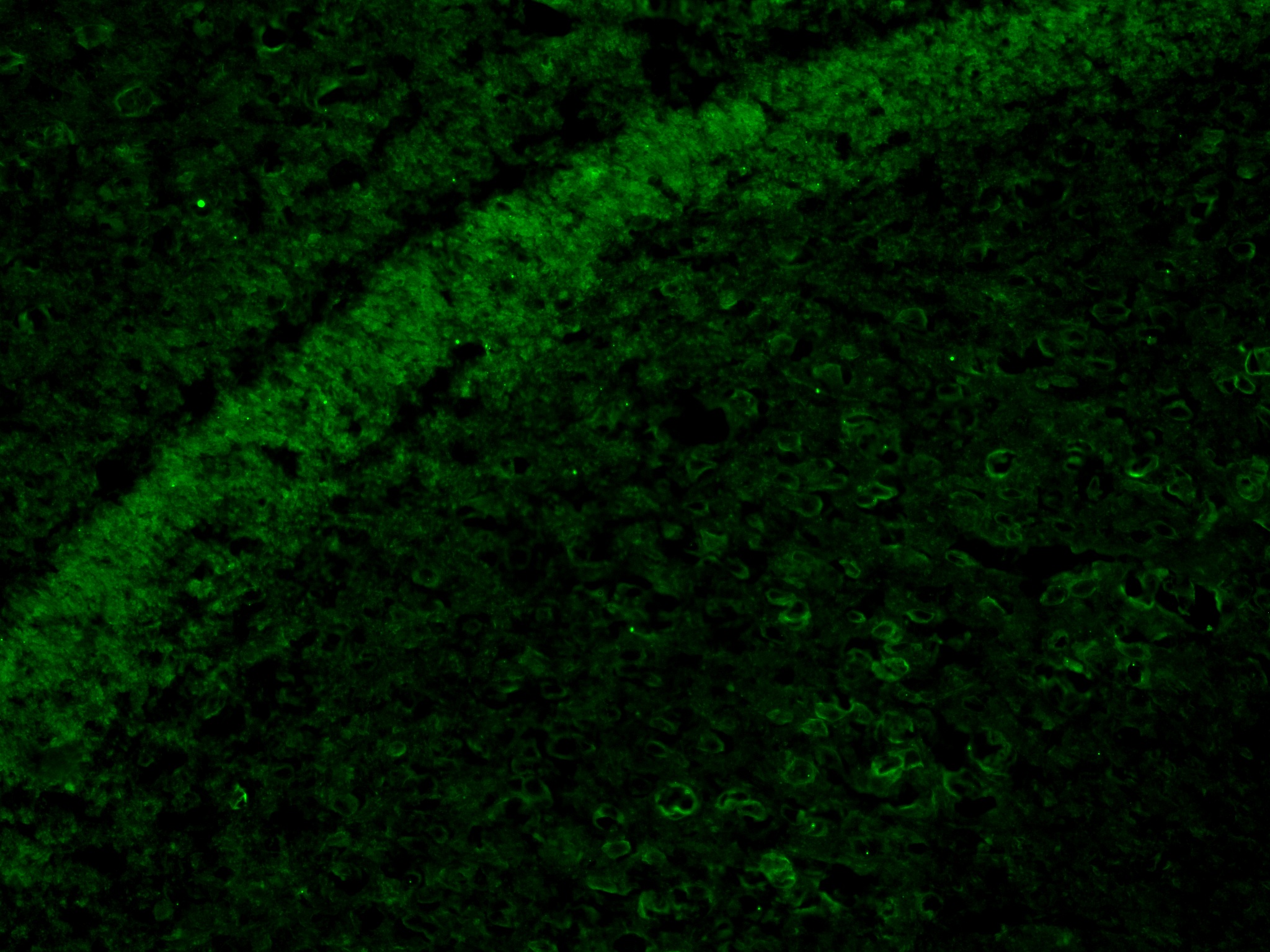 IF Staining of mouse brain using 81383-1-RR (same clone as 81383-1-PBS) IF Staining of mouse brain using 81383-1-RR (same clone as 81383-1-PBS)