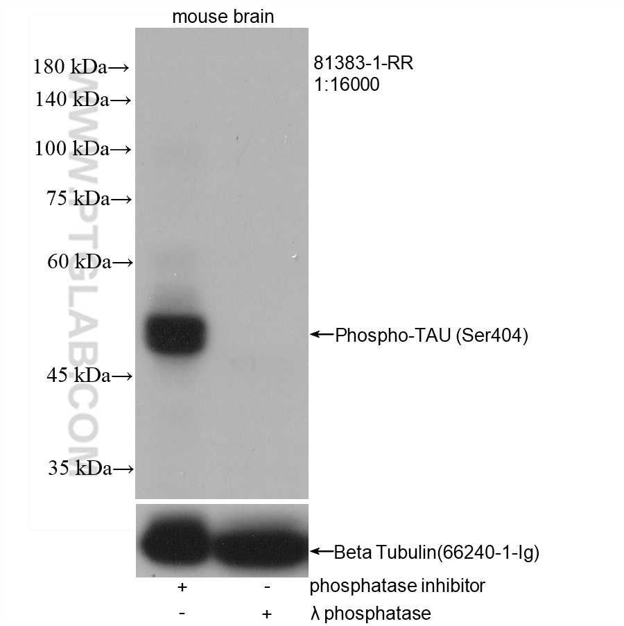 WB analysis of mouse brain using 81383-1-RR (same clone as 81383-1-PBS)