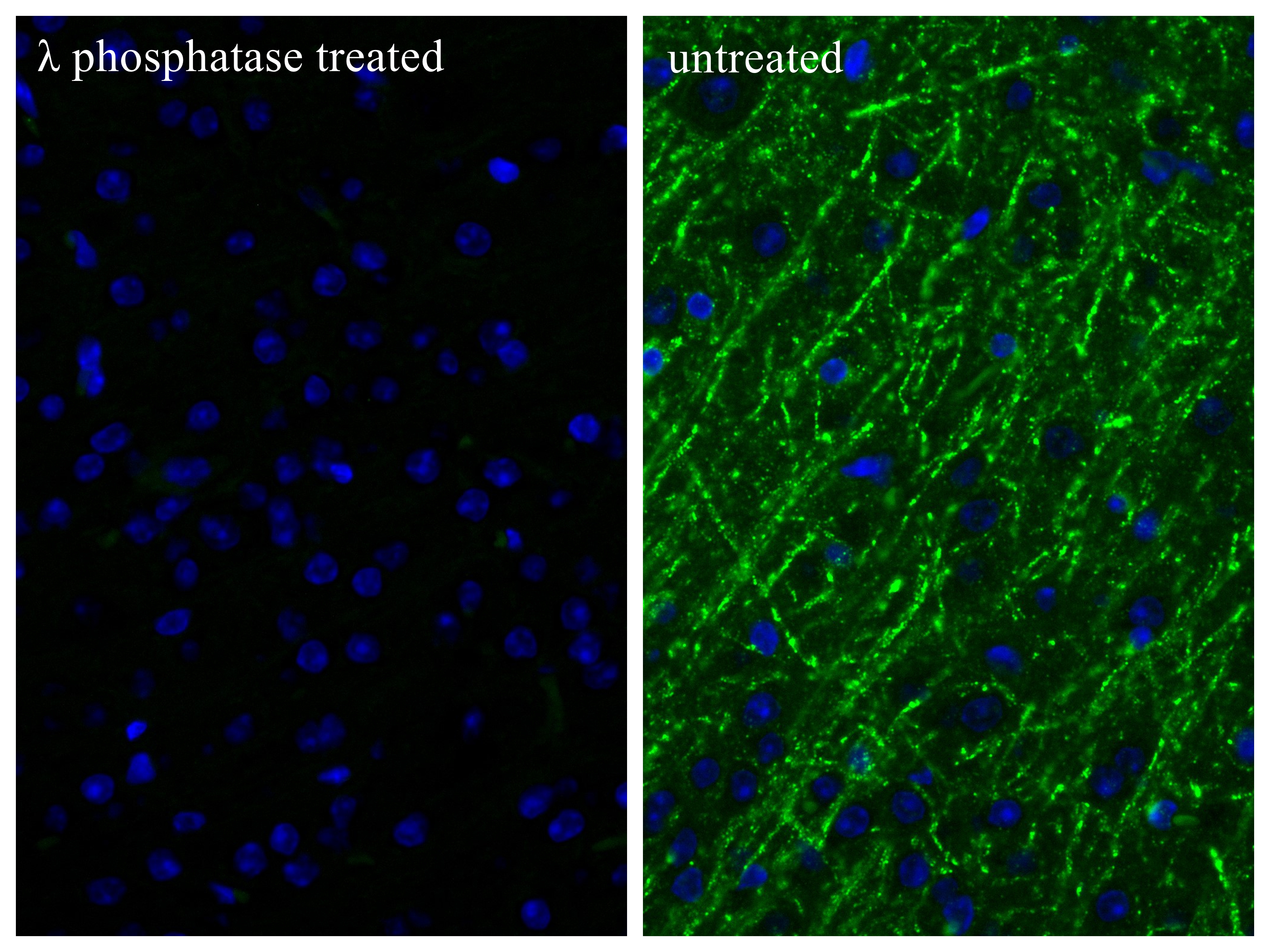 IF Staining of mouse brain using 87019-1-RR IF Staining of mouse brain using 87019-1-RR
