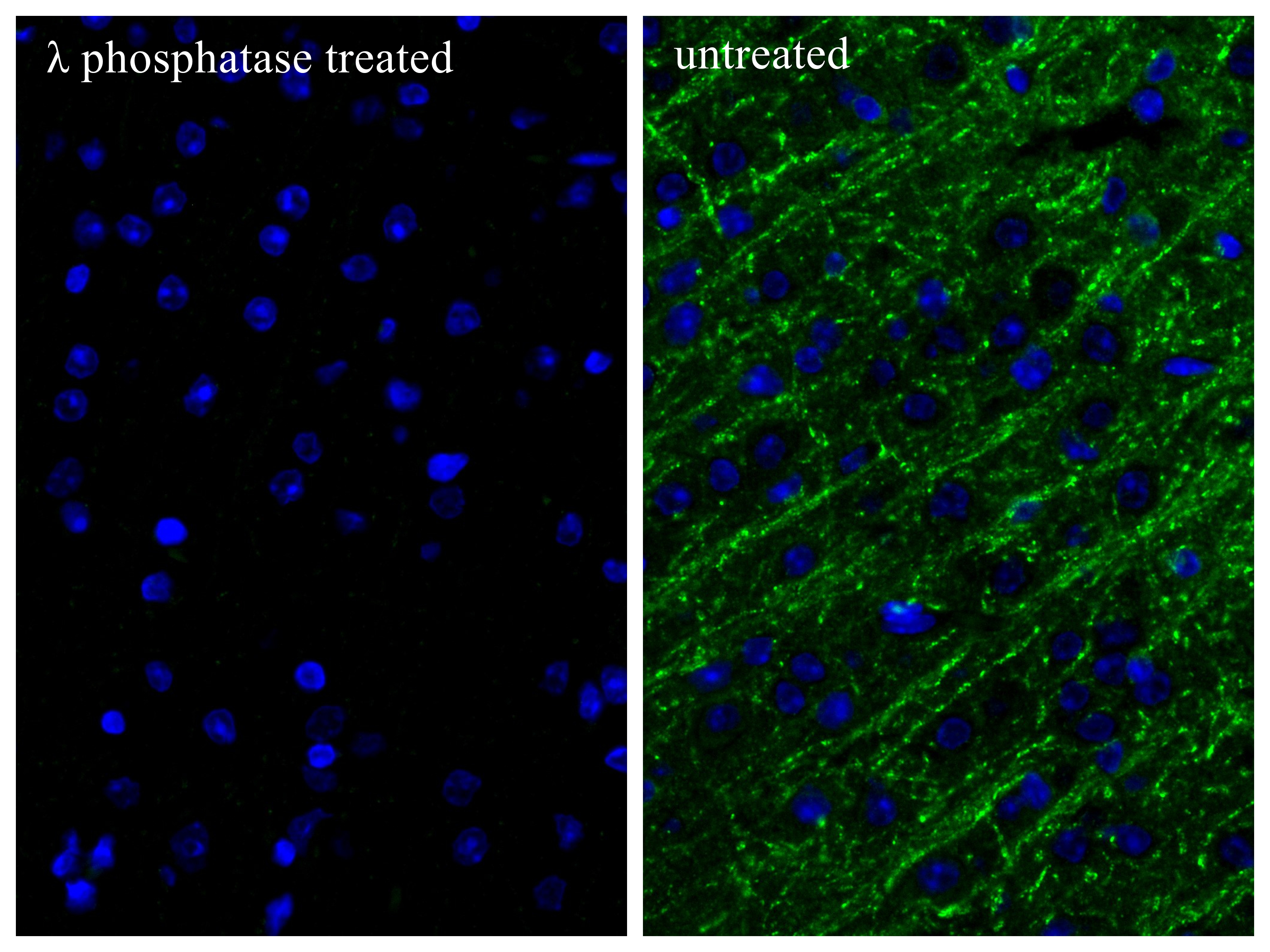 IF Staining of mouse brain using 87025-7-RR IF Staining of mouse brain using 87025-7-RR