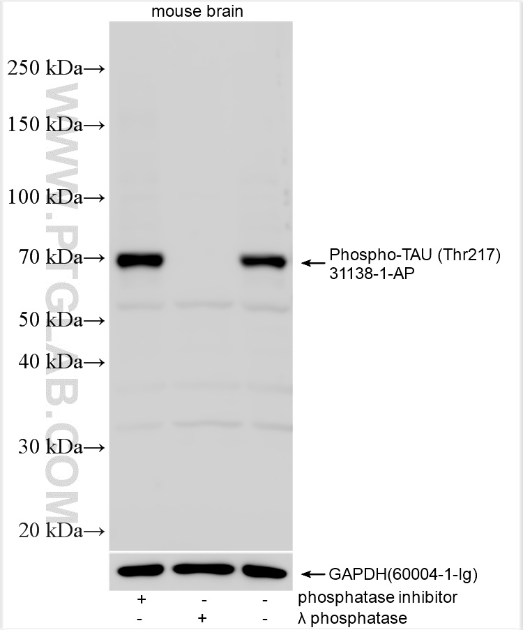 WB analysis using 31138-1-AP