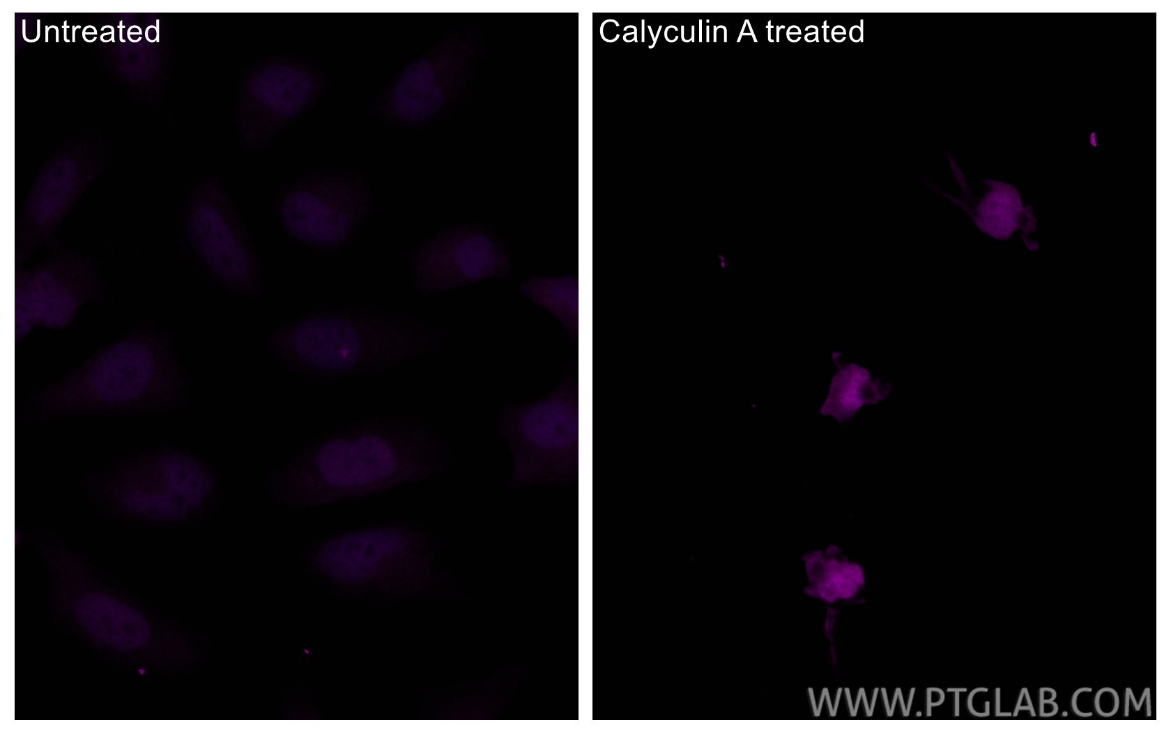 IF Staining of HeLa using CL647-80007