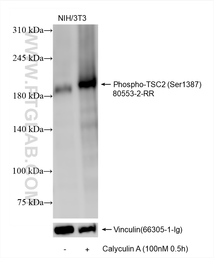 Non-treated and Calyculin A treated NIH/3T3 cells were subjected to SDS PAGE followed by western blot with 80553-2-RR (Phospho-TSC2 (<a class='green' href='/productredirect?CatalogNo=Ser1387' target='_blank'>Ser1387</a>) antibody) at dilution of 1:2000 incubated at room temperature for 1.5 hours. The membrane was stripped and re-blotted with Vinculin antibody (<a class='green' href='/productredirect?CatalogNo=66305-1-Ig' target='_blank'>66305-1-Ig</a>) as the loading control. WB analysis using 80553-2-RR