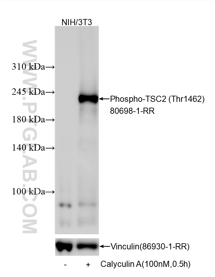 WB analysis using 80698-1-RR (same clone as 80698-1-PBS)
