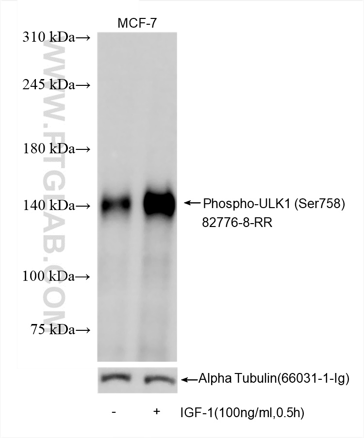 Non-treated and IGF-1 treated MCF-7 cells were subjected to SDS PAGE followed by western blot with 82776-8-RR (Phospho-ULK1 (Ser758) antibody) at dilution of 1:5000 incubated at room temperature for 1.5 hours. The membrane was tripped and re-blotted with Alpha Tubulin antibody (<a class='green' href='/productredirect?CatalogNo=66031-1-Ig' target='_blank'>66031-1-Ig</a>) as loading control. WB analysis using 82776-8-RR
