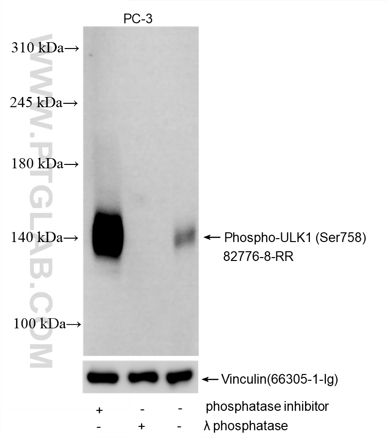 Non-treated, phosphatase inhibitor treated and λ phosphatase treated PC-3 cells were subjected to SDS PAGE followed by western blot with 82776-8-RR (Phospho-ULK1 (Ser758) antibody) at dilution of 1:5000 incubated at room temperature for 1.5 hours. The membrane was tripped and re-blotted with Vinculin antibody (<a class='green' href='/productredirect?CatalogNo=66305-1-Ig' target='_blank'>66305-1-Ig</a>) as loading control. WB analysis using 82776-8-RR