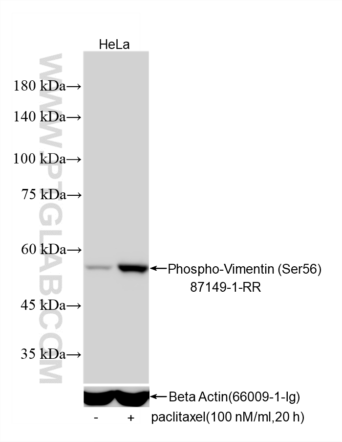 WB analysis using 87149-1-RR