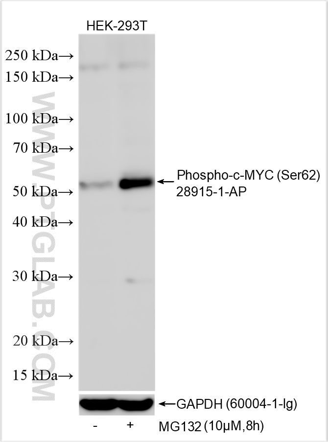 WB analysis using 28915-1-AP