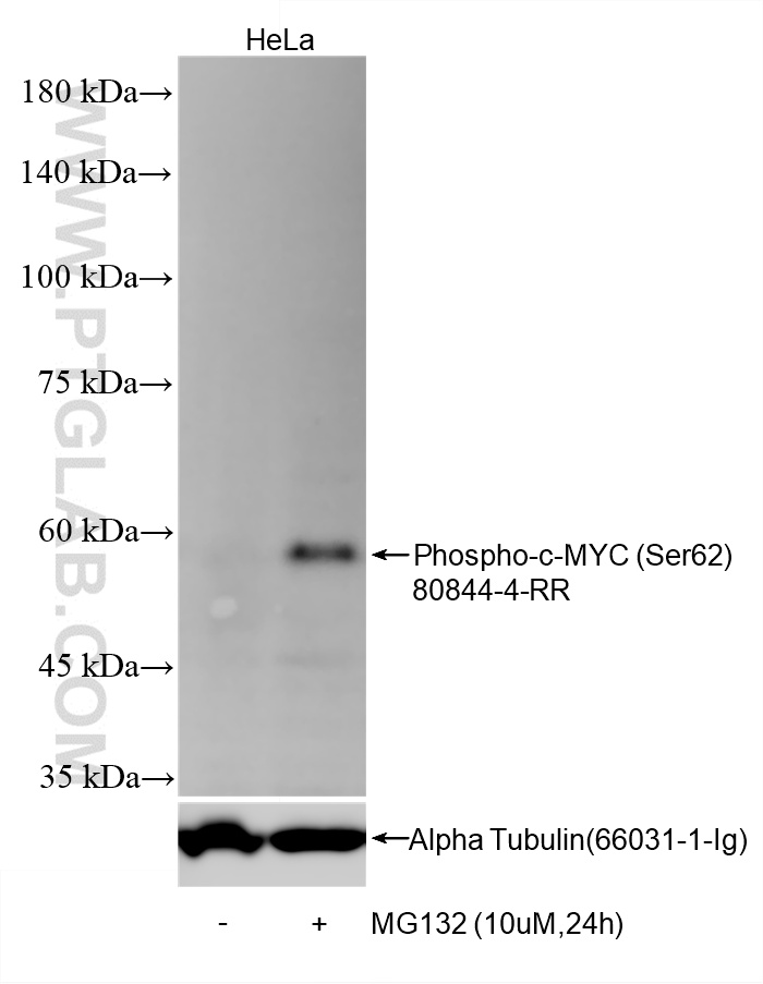 WB analysis of HeLa using 80844-4-RR