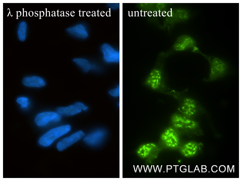 IF Staining of HEK-293 using 80706-3-RR IF Staining of HEK-293 using 80706-3-RR