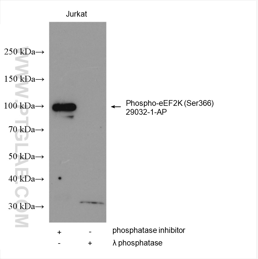 Phospho-eEF2K (Ser366)