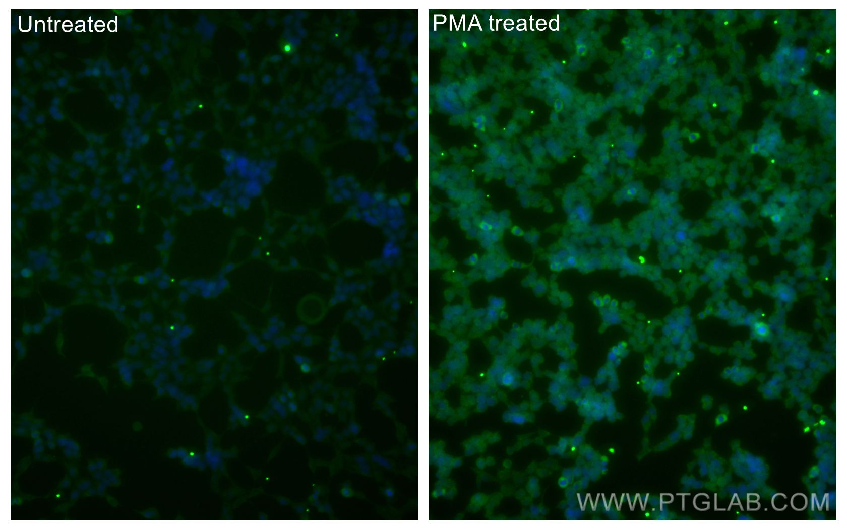 Phospho-mTOR (Ser2448)