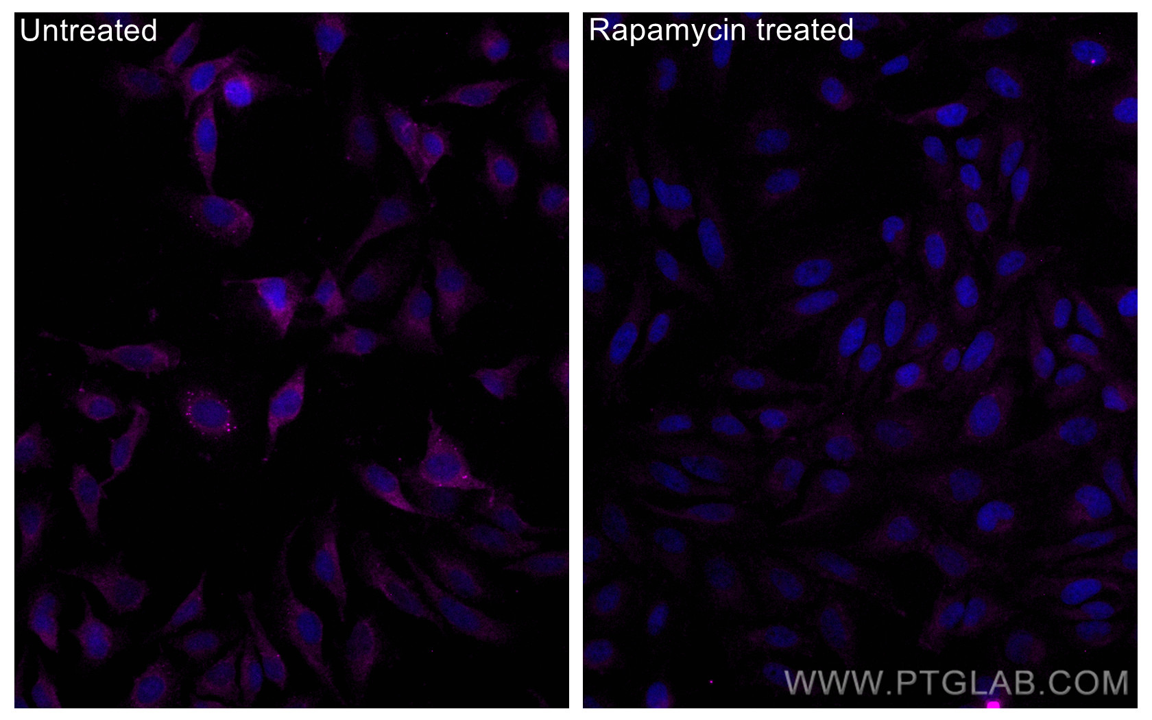 IF Staining of HeLa using CL647-80596