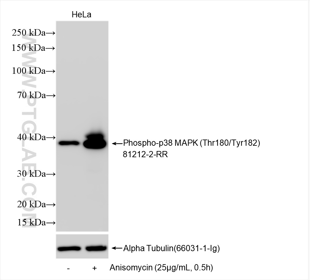WB analysis using 81212-2-RR (same clone as 81212-2-PBS)