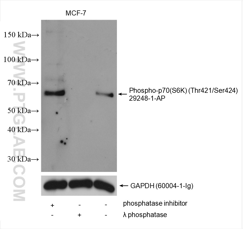 Phospho-p70(S6K) (Thr421/Ser424)