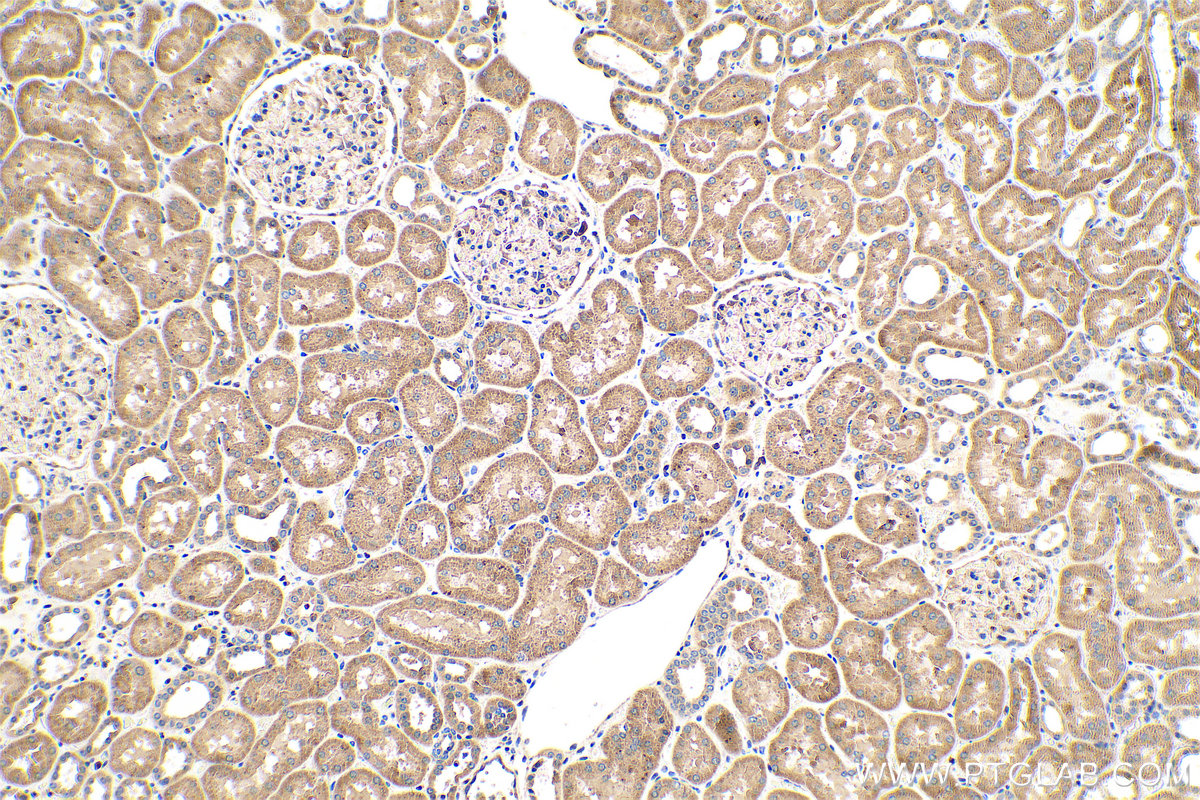 IHC staining of human kidney using 55463-1-AP