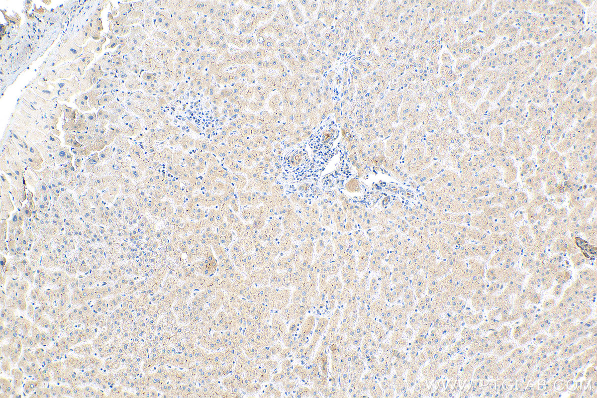 IHC staining of human liver using 26205-1-AP