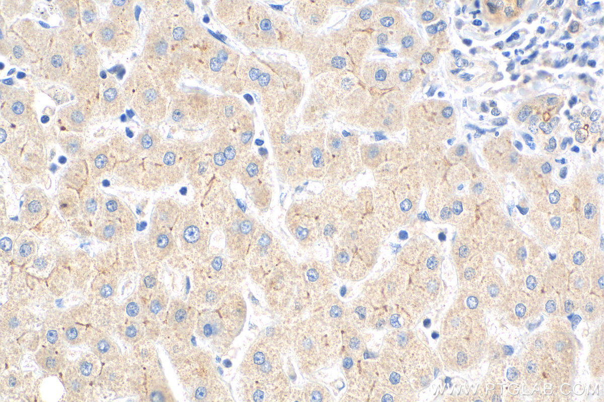 IHC staining of human liver using 26205-1-AP