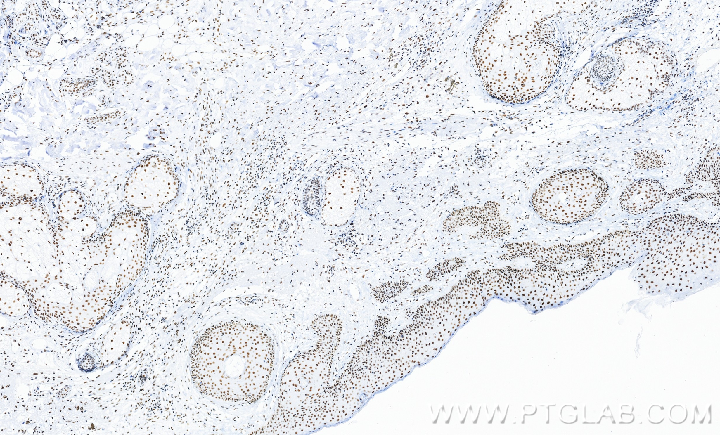 IHC staining of human skin using 86292-1-RR