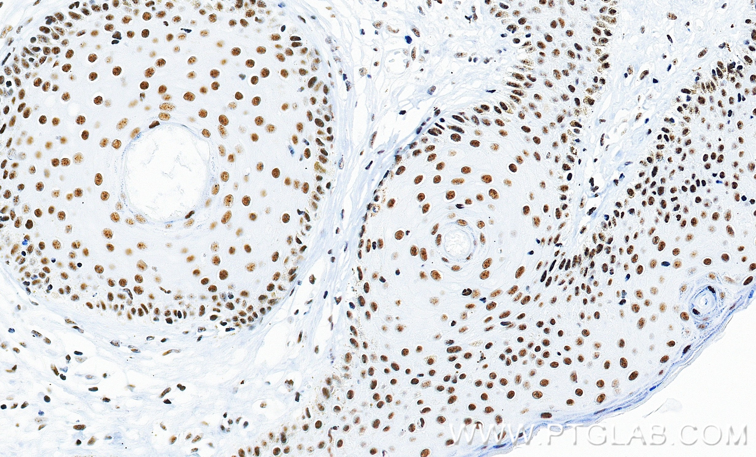 IHC staining of human skin using 86292-1-RR