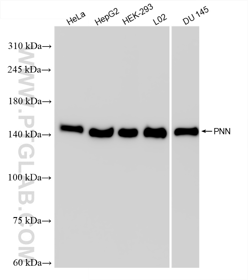 Various lysates were subjected to SDS PAGE followed by western blot with 86292-1-RR (PNN antibody) at dilution of 1:10000 incubated at room temperature for 1.5 hours. WB analysis using 86292-1-RR