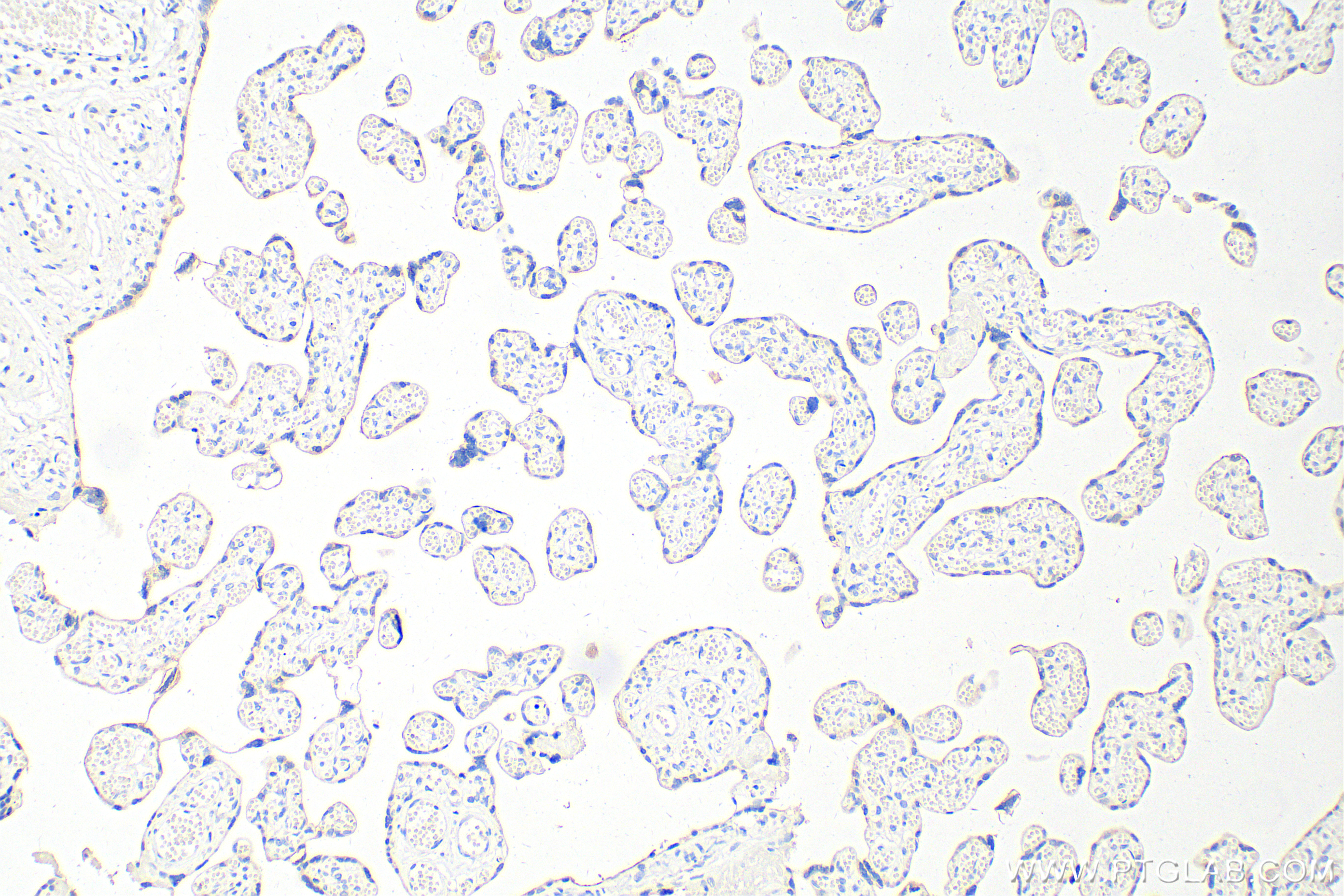 IHC staining of human placenta using 66728-1-Ig (same clone as 66728-1-PBS)