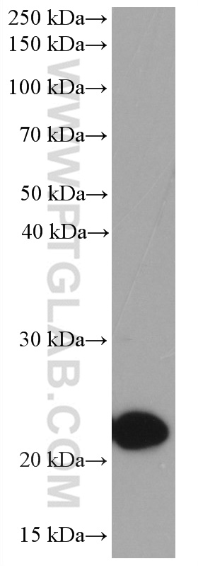 WB analysis of human placenta using 66728-1-Ig (same clone as 66728-1-PBS)