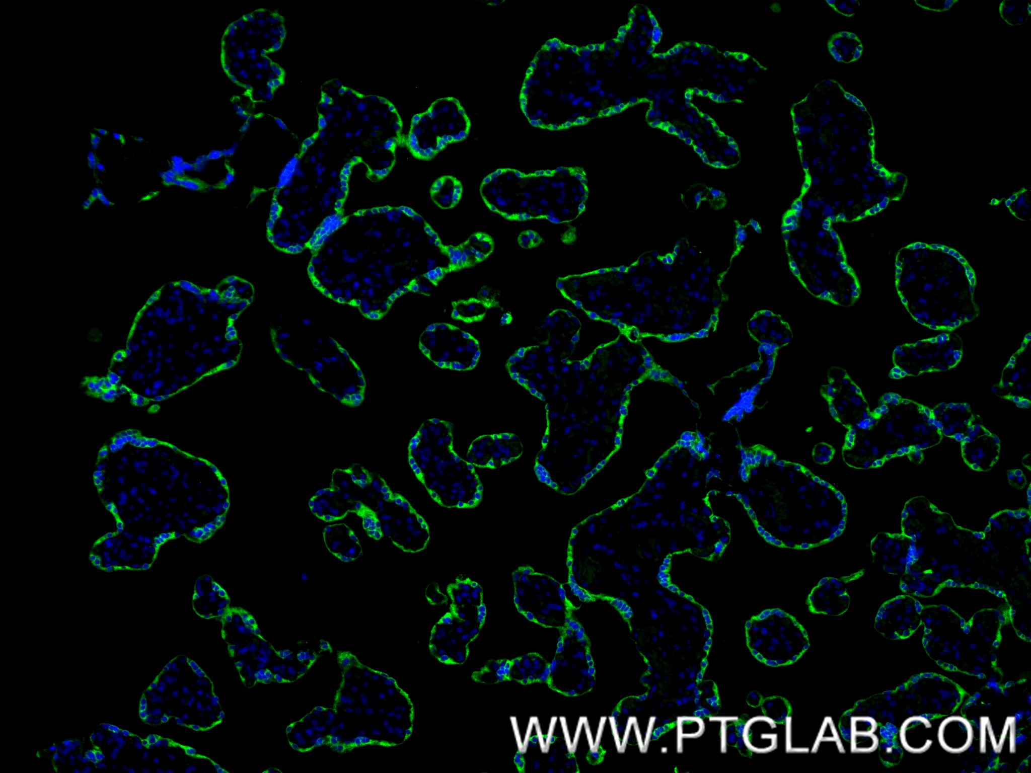 IF Staining of human placenta using 86658-1-RR IF Staining of human placenta using 86658-1-RR