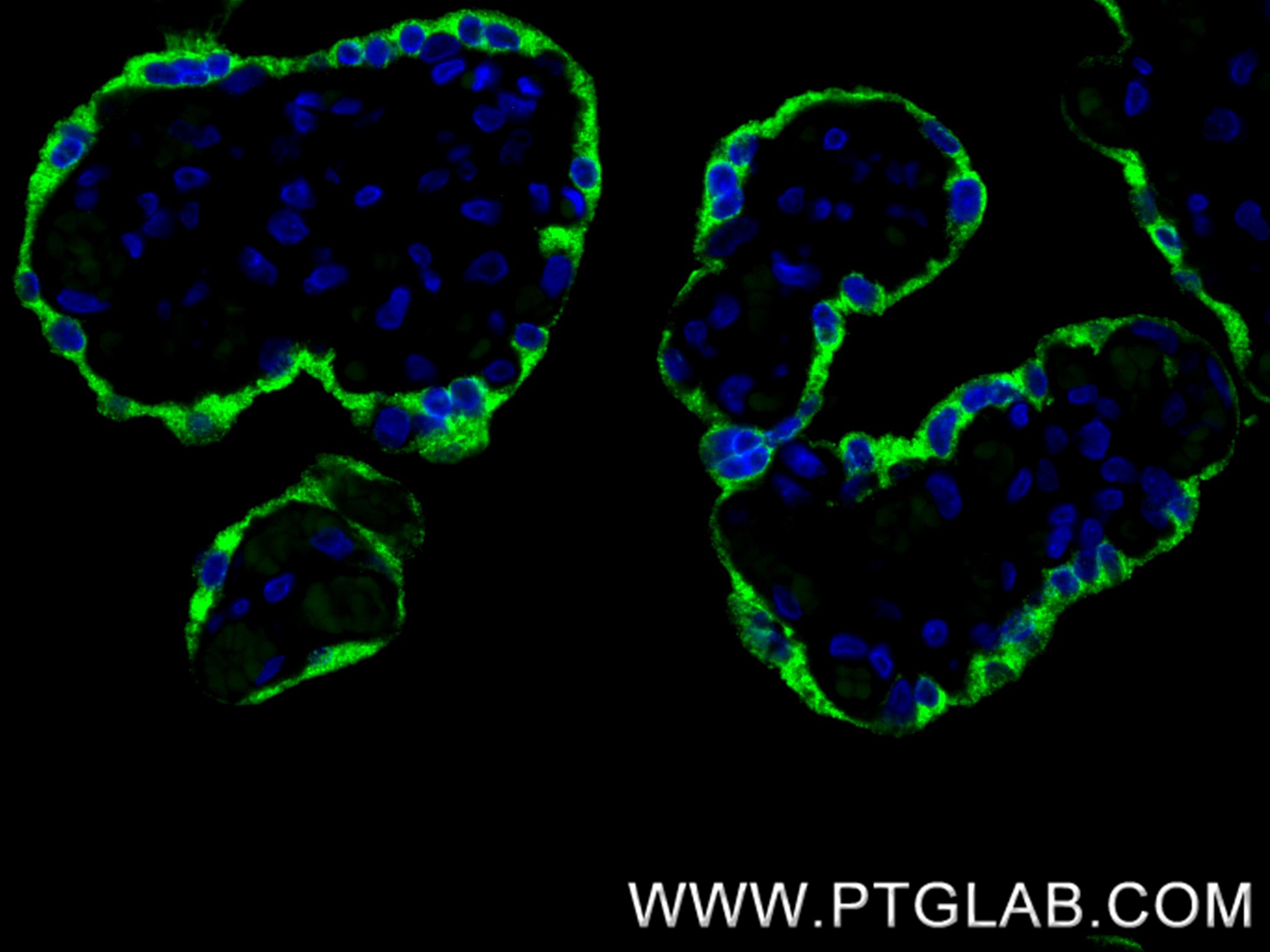 IF Staining of human placenta using 86658-1-RR IF Staining of human placenta using 86658-1-RR