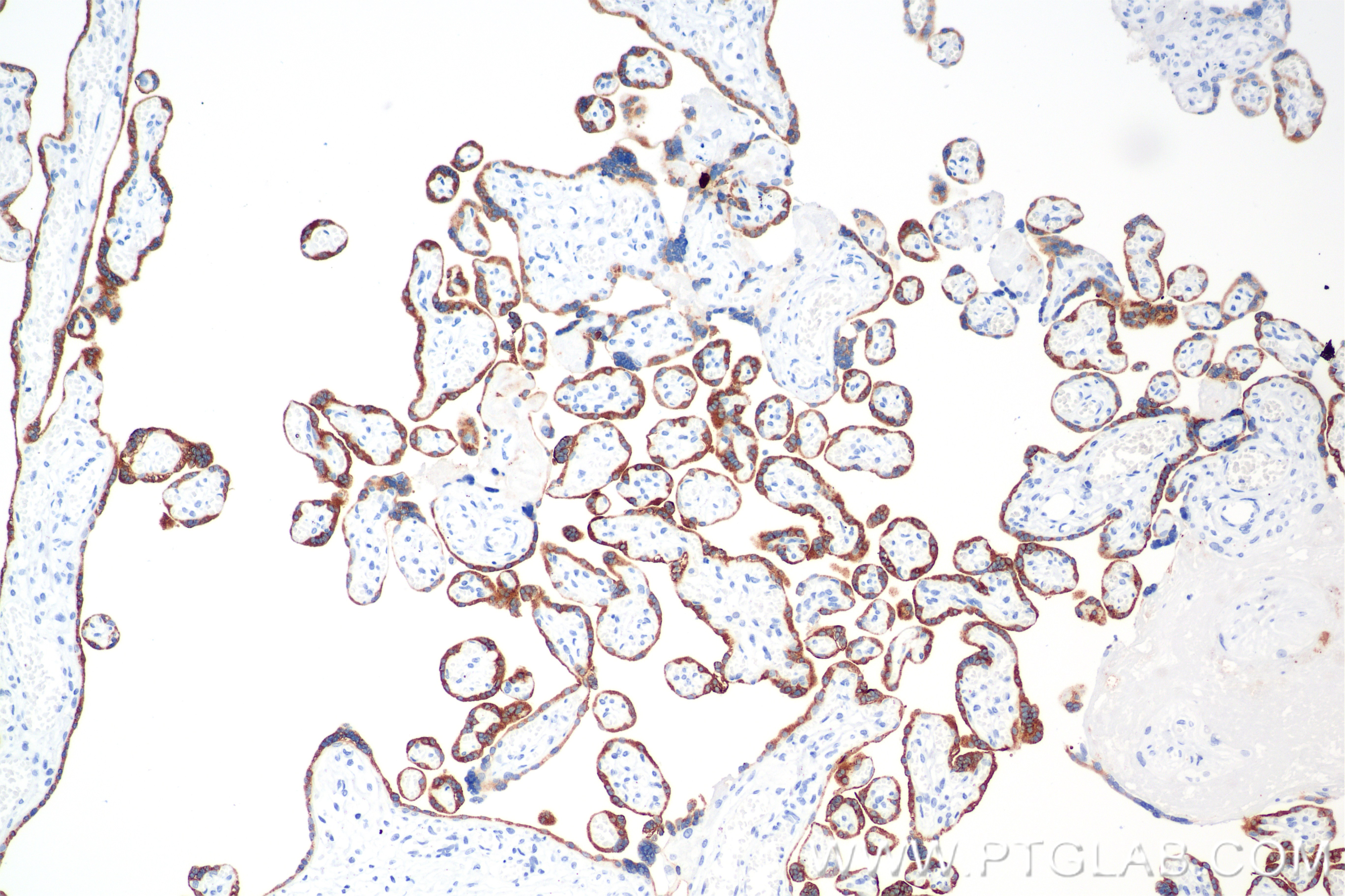 IHC staining of human placenta using 86658-1-RR (same clone as 86658-1-PBS)