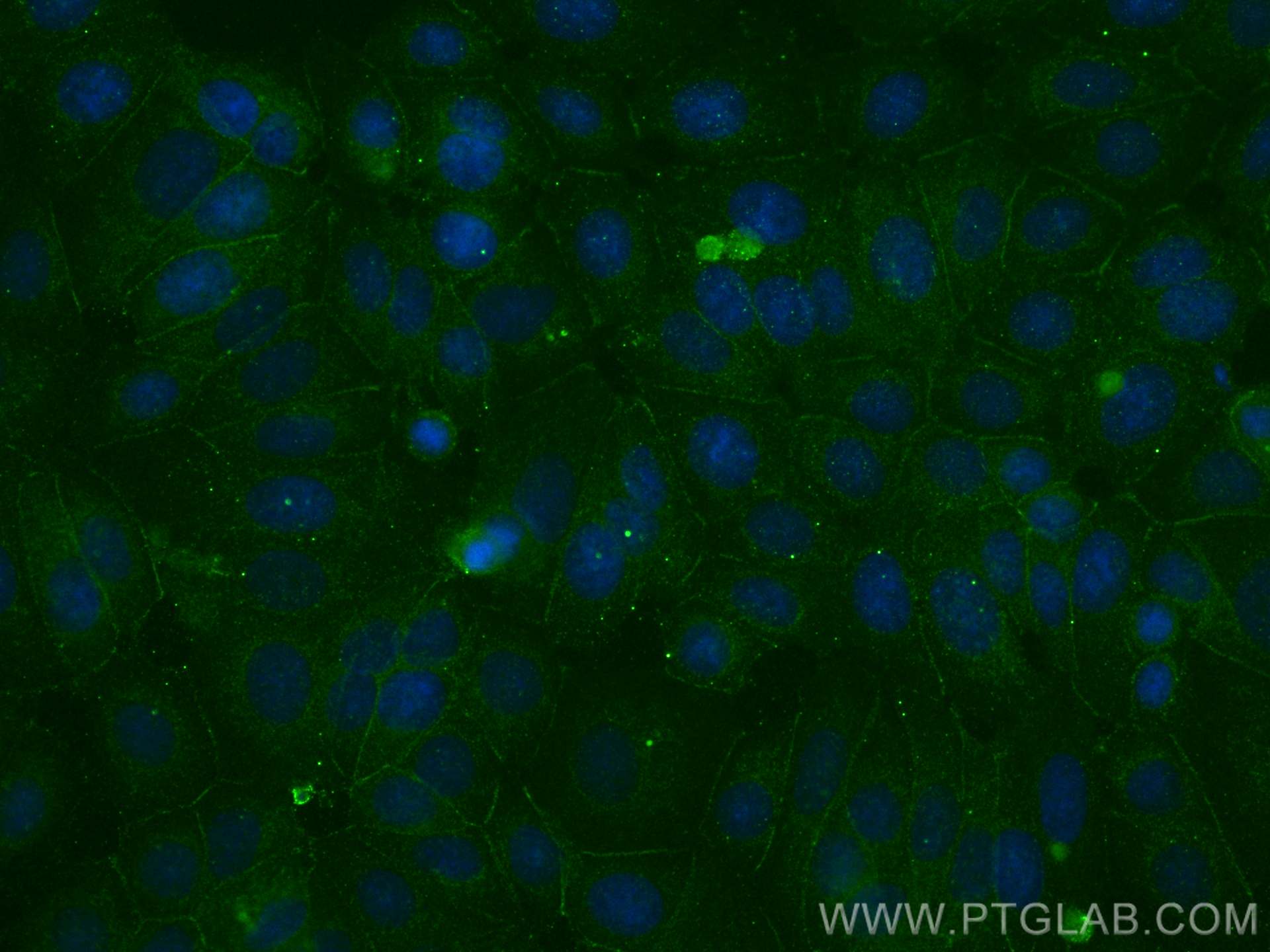 IF Staining of MCF-7 using 66445-1-Ig (same clone as 66445-1-PBS)