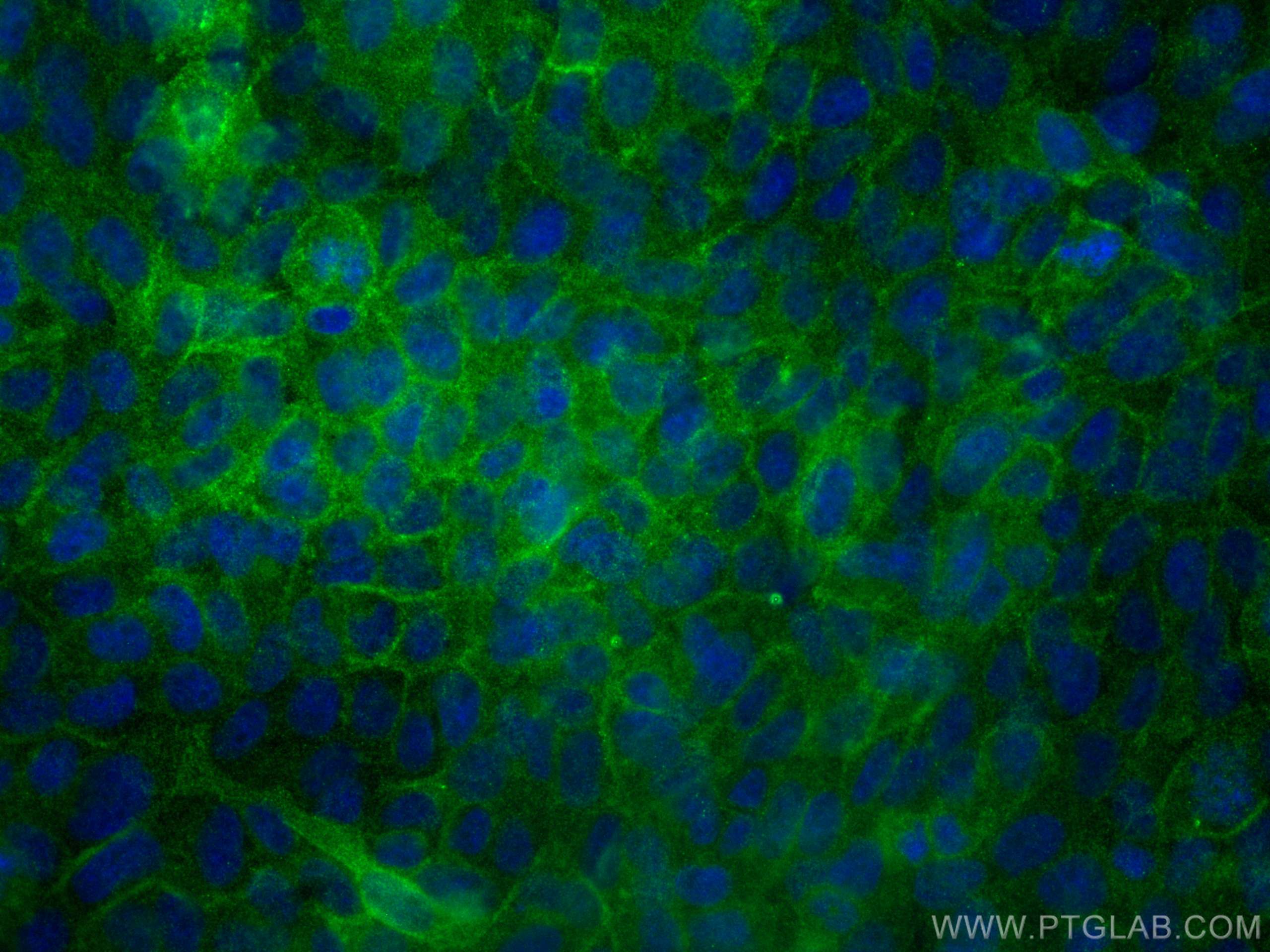 IF Staining of A431 using 66445-1-Ig