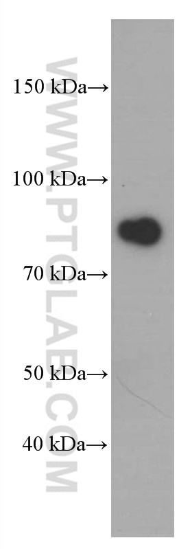WB analysis of human heart using 66445-1-Ig (same clone as 66445-1-PBS)