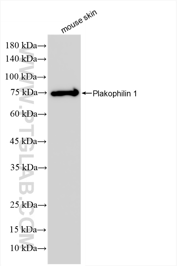 WB analysis of mouse skin using 85217-4-RR